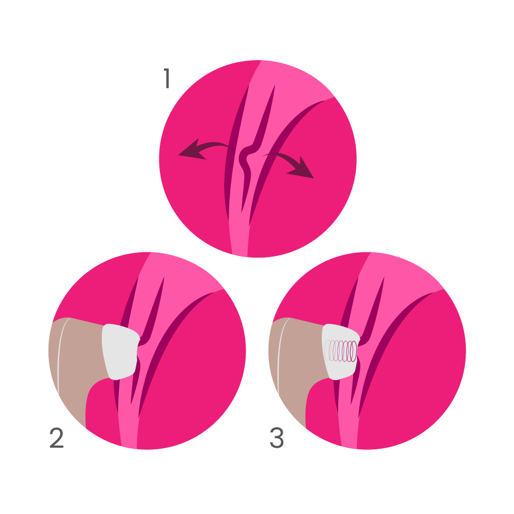 Satisfyer Pro 2 - Succionador de clítoris | Ondas de presión y orgasmos intensos